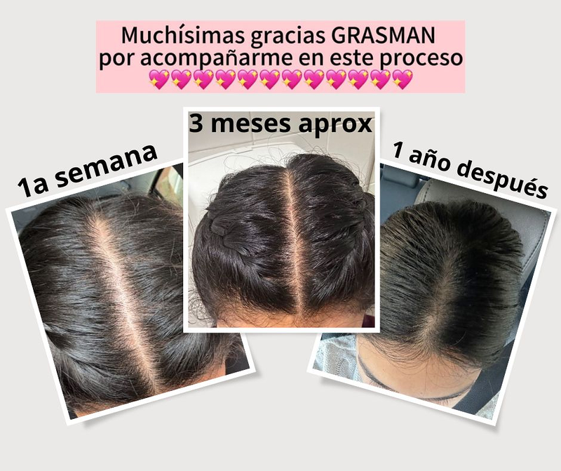 Grasman Centro Dermo-Capilar 7