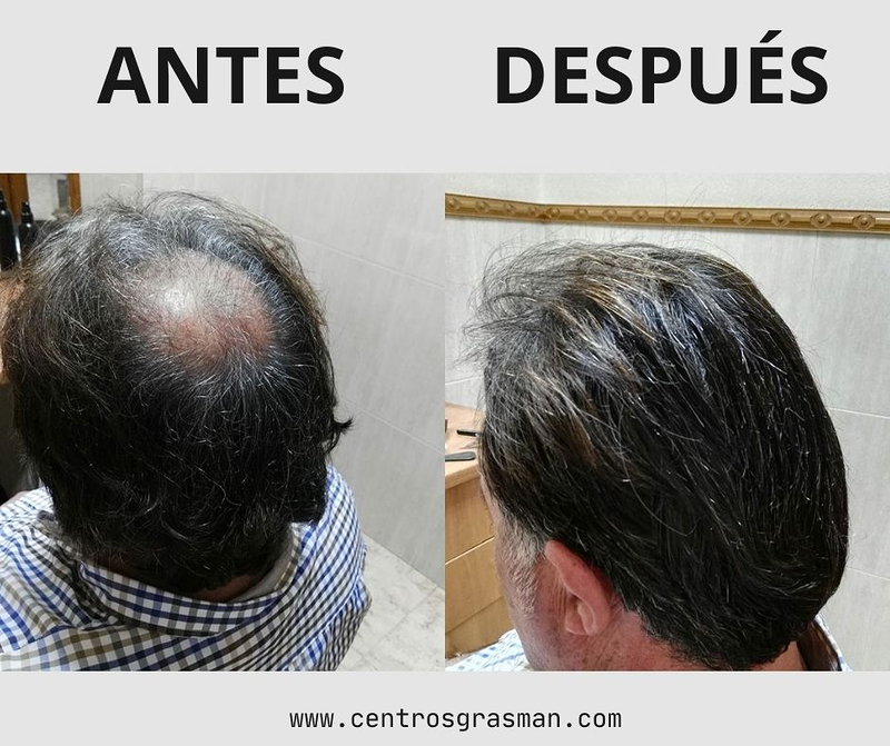 Grasman Centro Dermo-Capilar 3