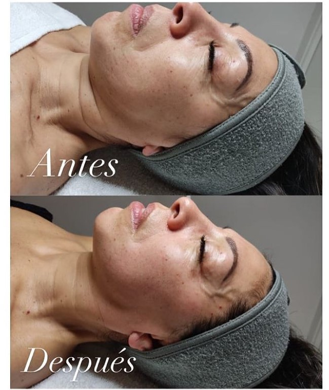 Shakti Belleza Hol&iacute;stica València