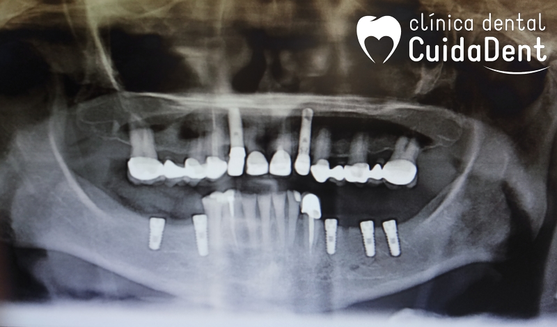 Clínica Dental Cuidadent 3