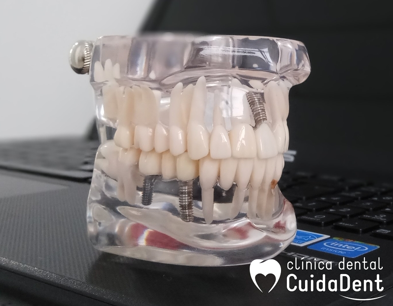 Clínica Dental Cuidadent 4