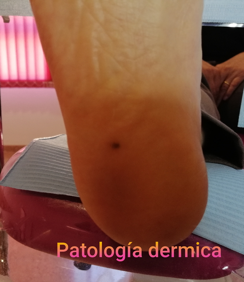 Clínica Podológica Barbera Castalla