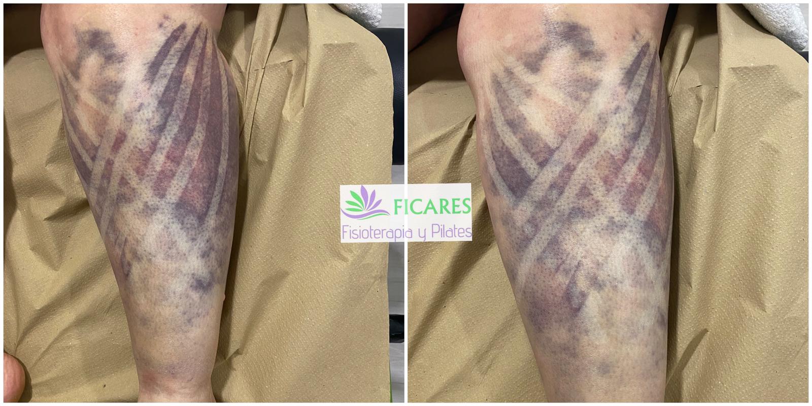 Ficares fisioterapia y Pilates 4