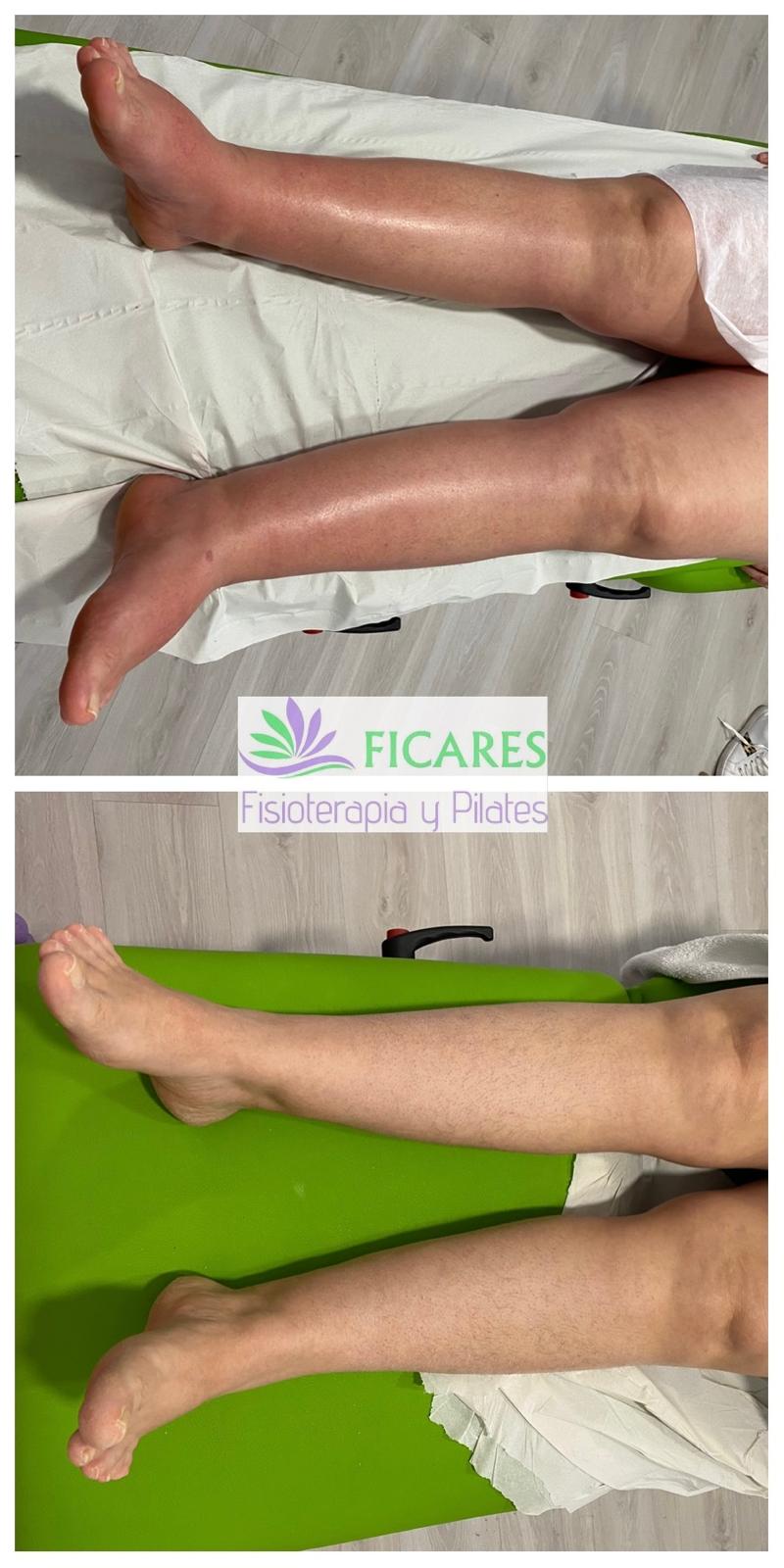 Ficares fisioterapia y Pilates 11