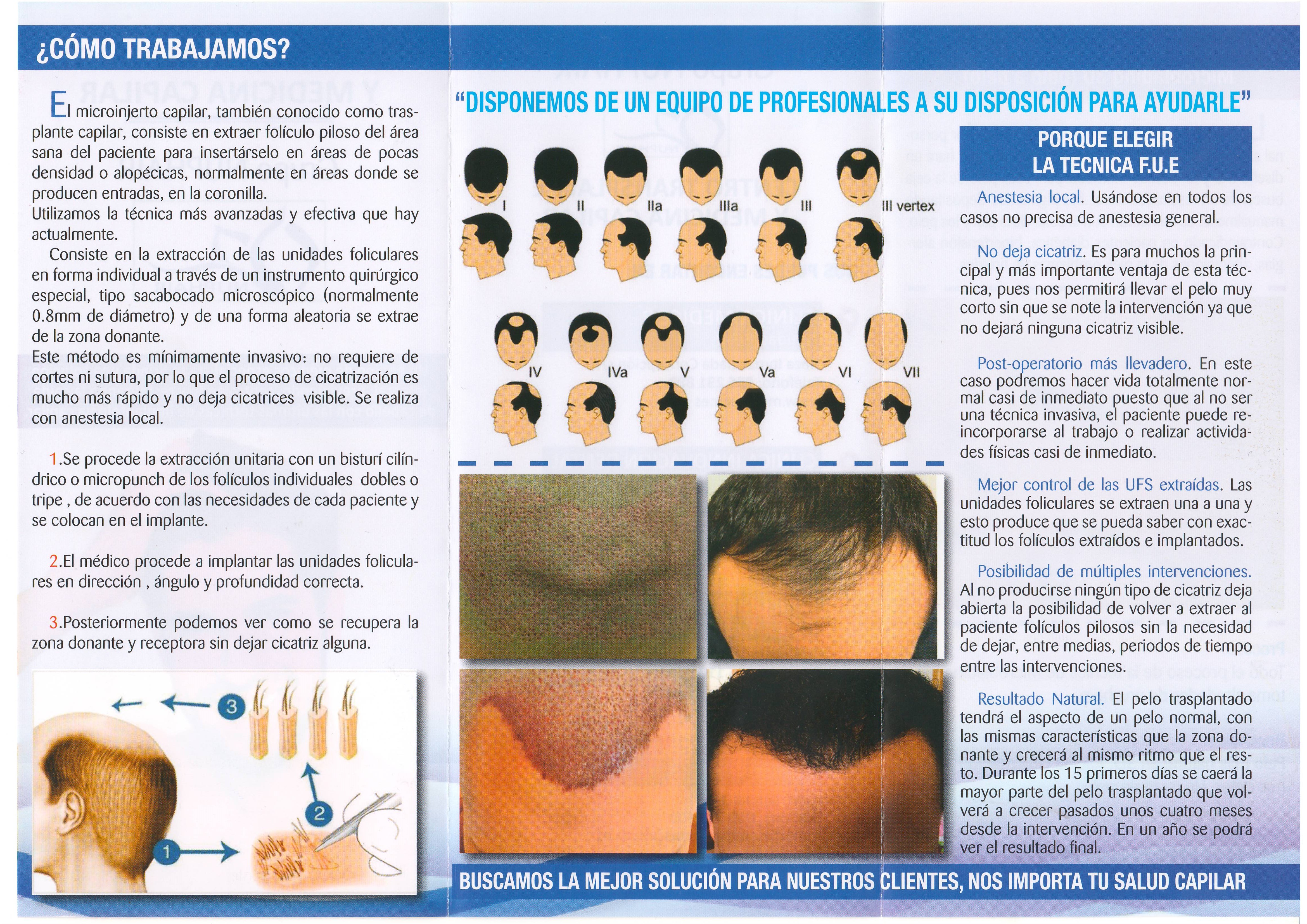 Galería de imágenes