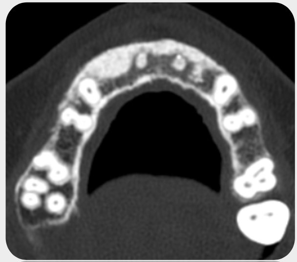 Clínica Dental MIBO Almería 2