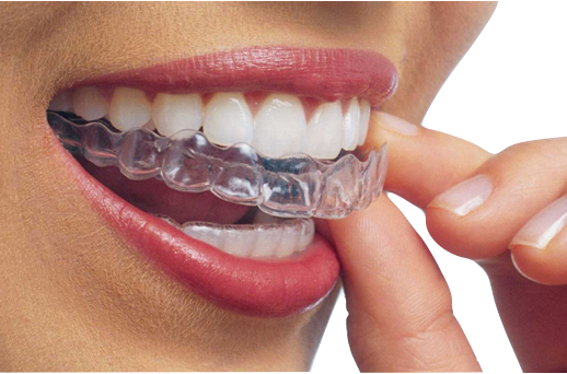 Clínica Dental MIBO Almería 4