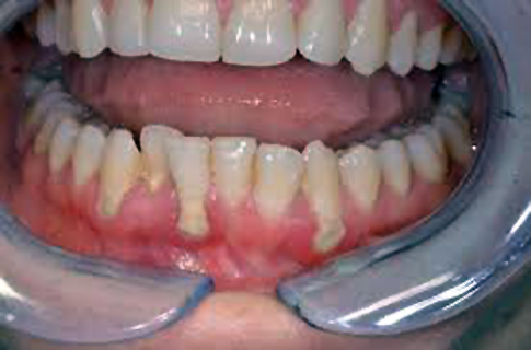 Magoidental 6