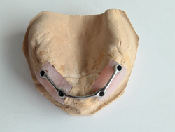 Laboratorio Dental Nogodent 2 Laboratorio Dental Nogodent 2