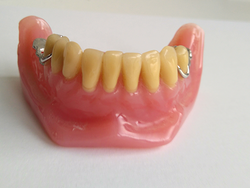 Laboratorio Dental Nogodent Sant Just Desvern Laboratorio Dental Nogodent Sant Just Desvern
