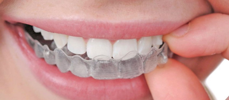 Cl&iacute;nica Dental Stenon 5