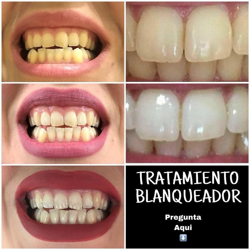 We Are The Project 18