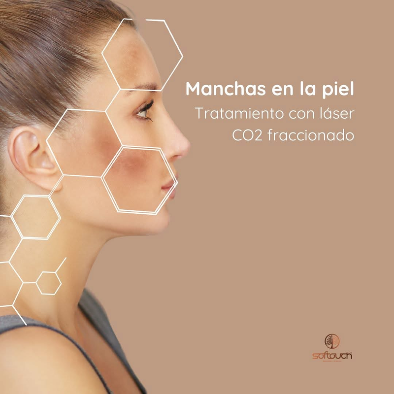 Softouch Medicina y Cirugía Estética 13