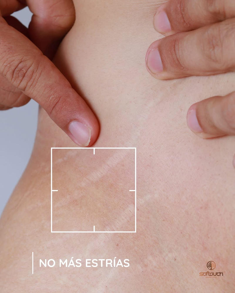 Softouch Medicina y Cirugía Estética 17