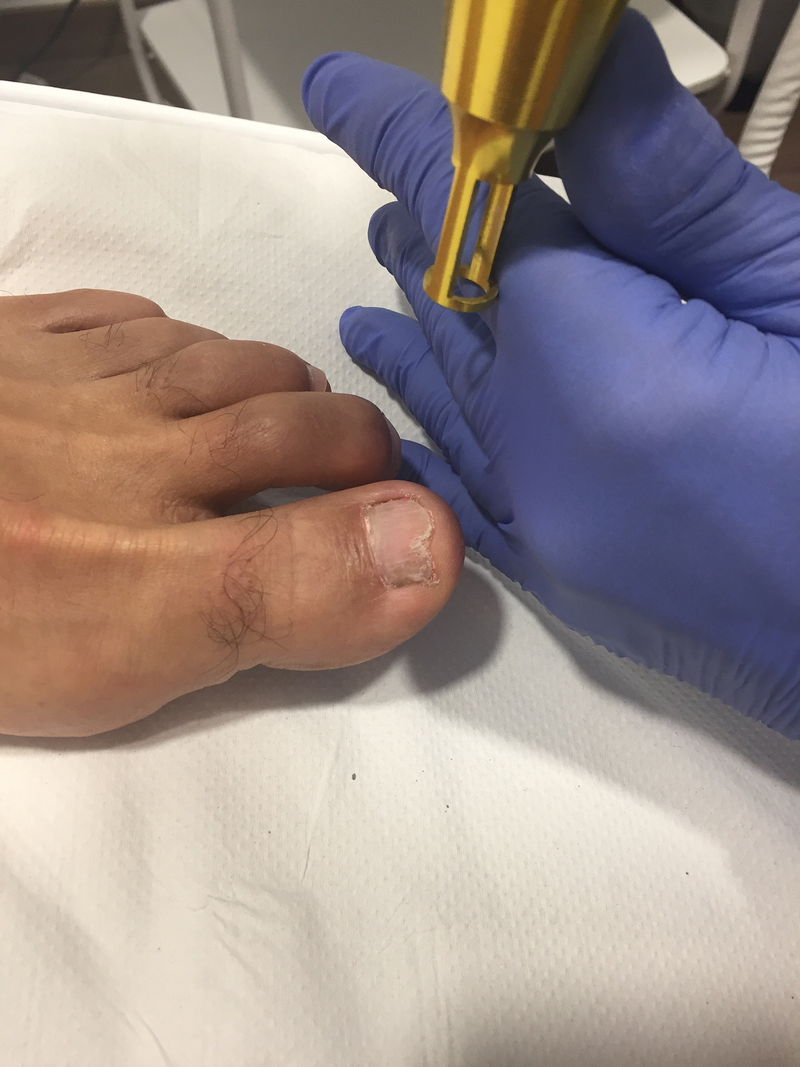 Sin Huella M&eacute;rida 6