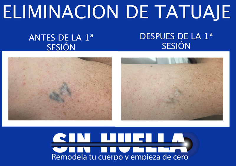 Sin Huella M&eacute;rida 5