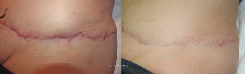 Rahel Laser Klinika 8