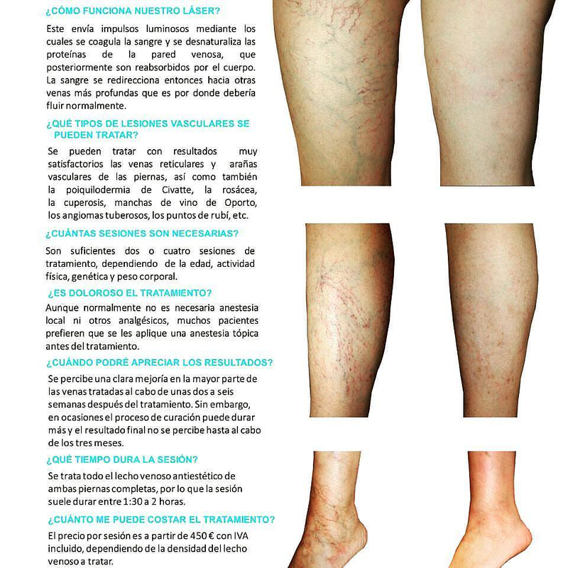 Rahel Laser Klinika 9