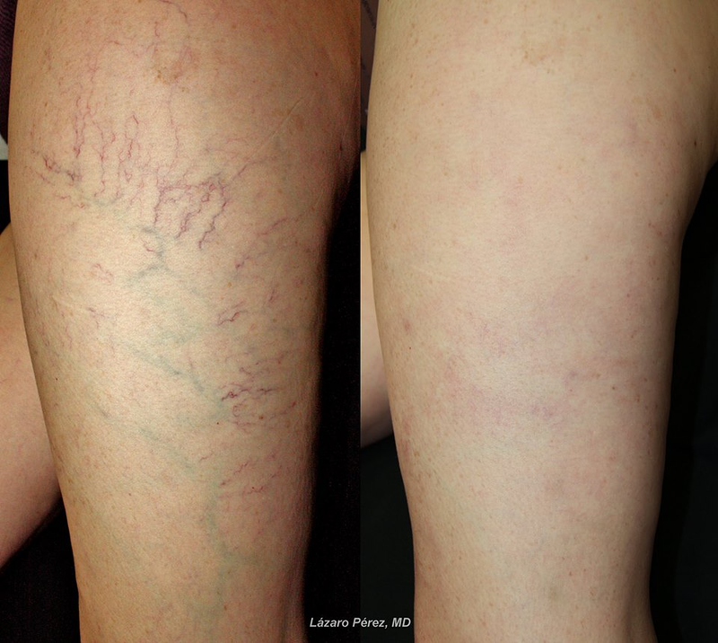 Rahel Laser Klinika 6