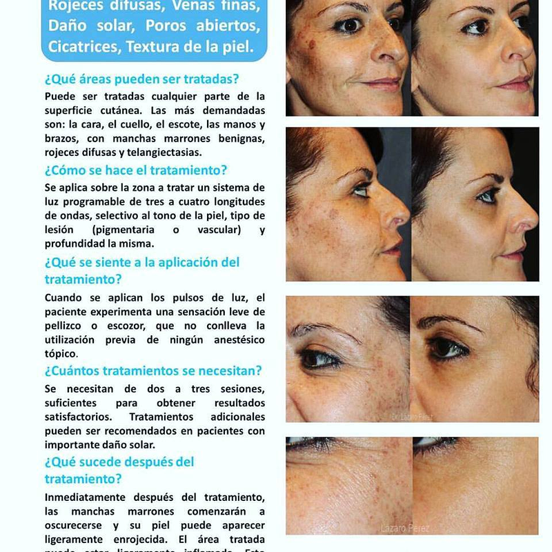 Rahel Laser Klinika 10