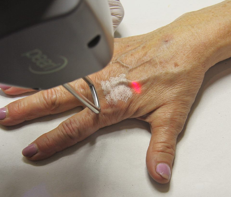 Rahel Laser Klinika 2