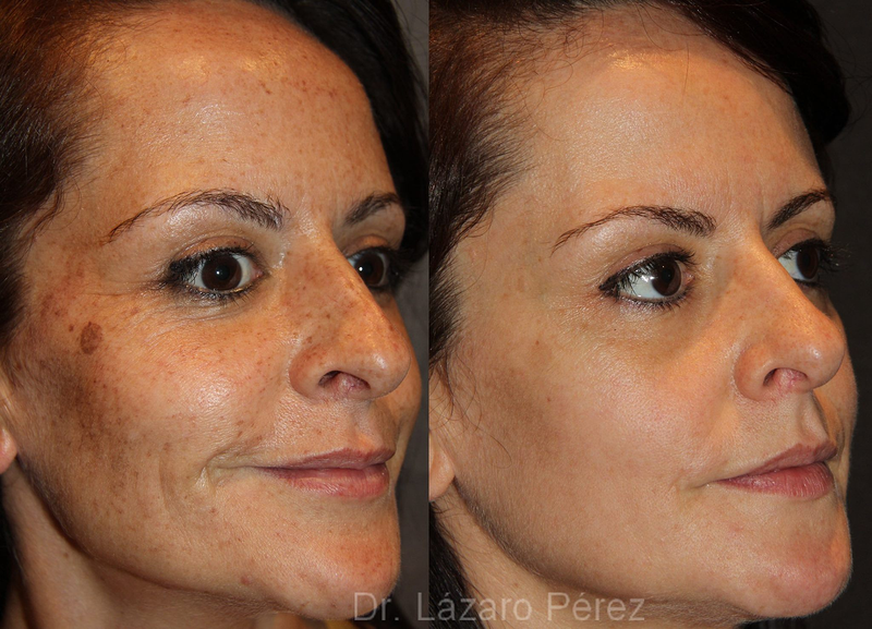 Rahel Laser Klinika 3