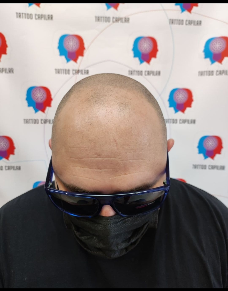 Killer Tattoo & Tattoo Capilar 8