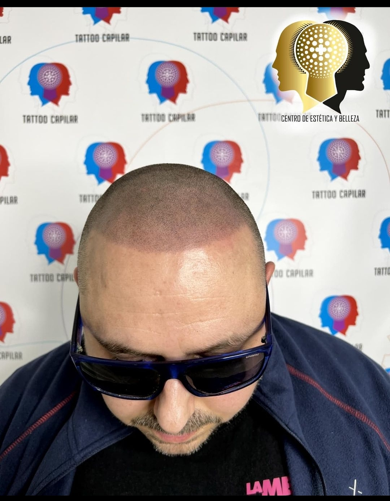 Killer Tattoo & Tattoo Capilar 9