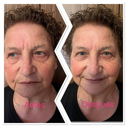 Galería de imágenes