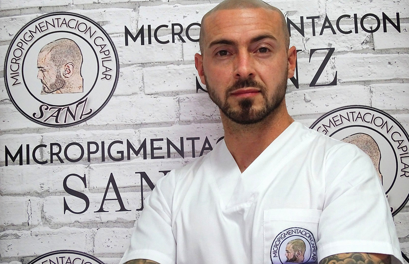 Micropigmentacion Capilar Sanz. Micropigmentacion Capilar En Cordoba y en Jaen. 3