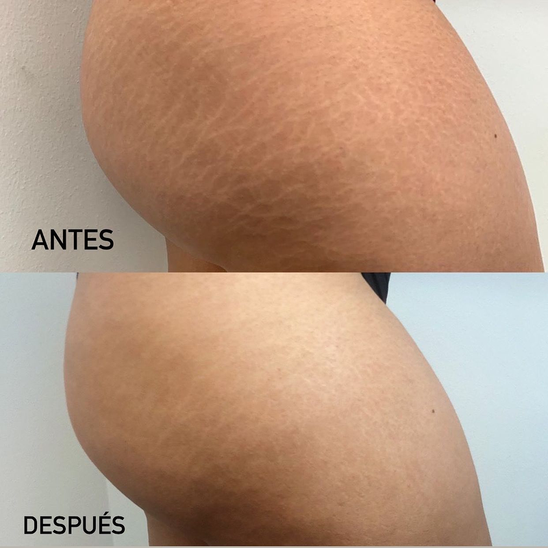 Microblading Barcelona - Micropigmentaci&oacute;n Barcelona - Hely Poveda ESTETICA: CENTROS