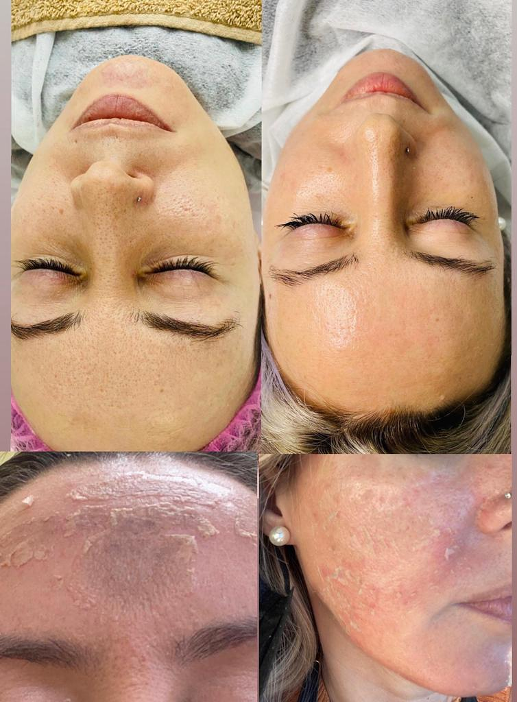 Microblading Barcelona - Micropigmentaci&oacute;n Barcelona - Hely Poveda 6