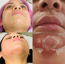 Galería de imágenes