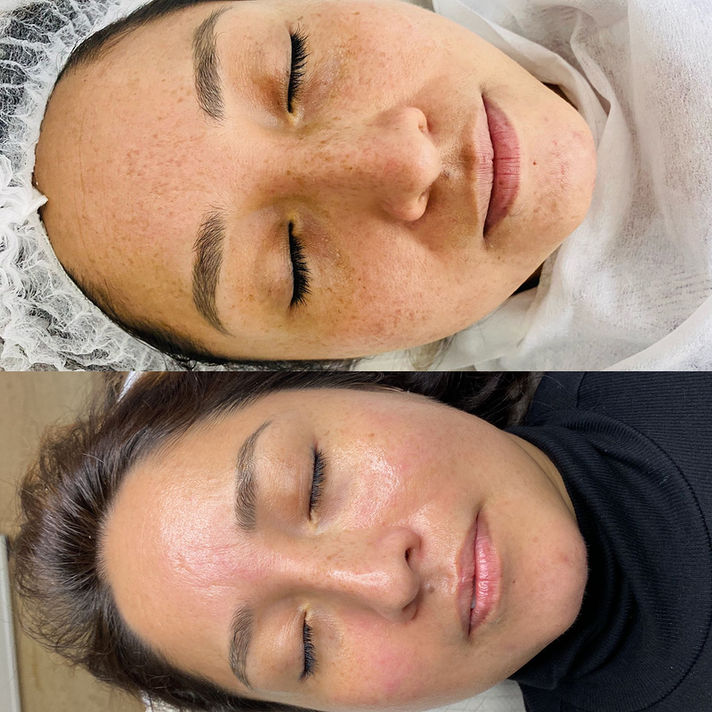 Microblading Barcelona - Micropigmentaci&oacute;n Barcelona - Hely Poveda 7