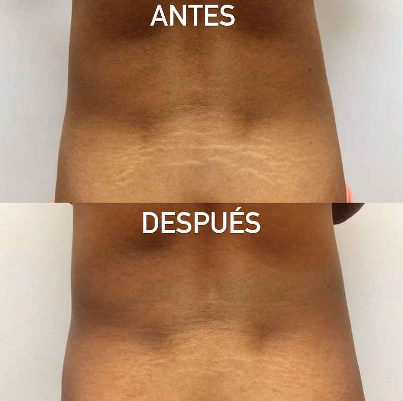 Microblading Barcelona - Micropigmentaci&oacute;n Barcelona - Hely Poveda Barcelona