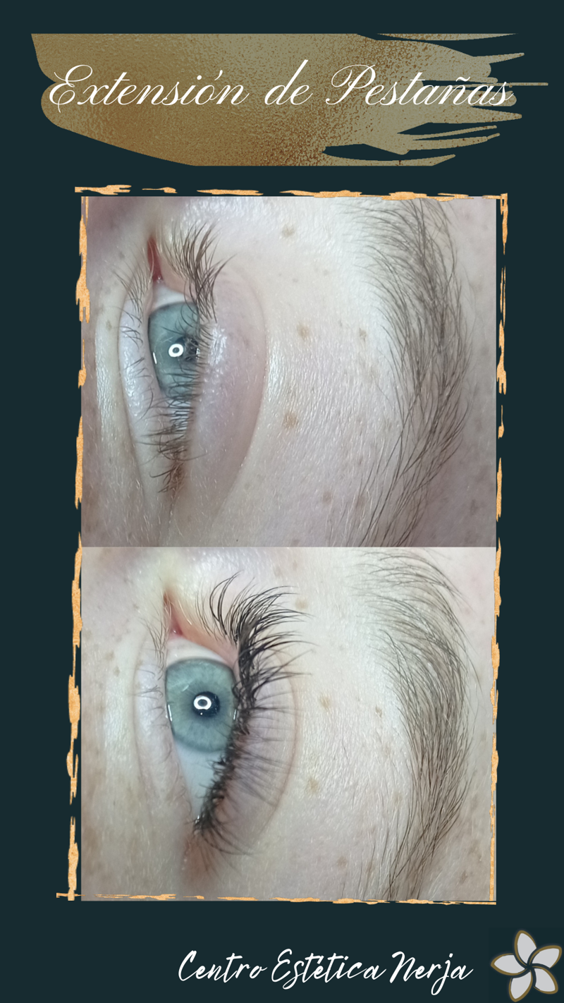 Centro Est&eacute;tica Nerja ESTETICA: CENTROS