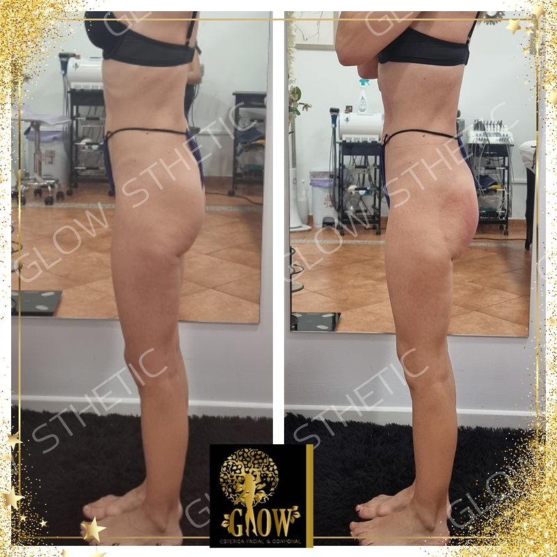 Glow Biosthetic El Ejido