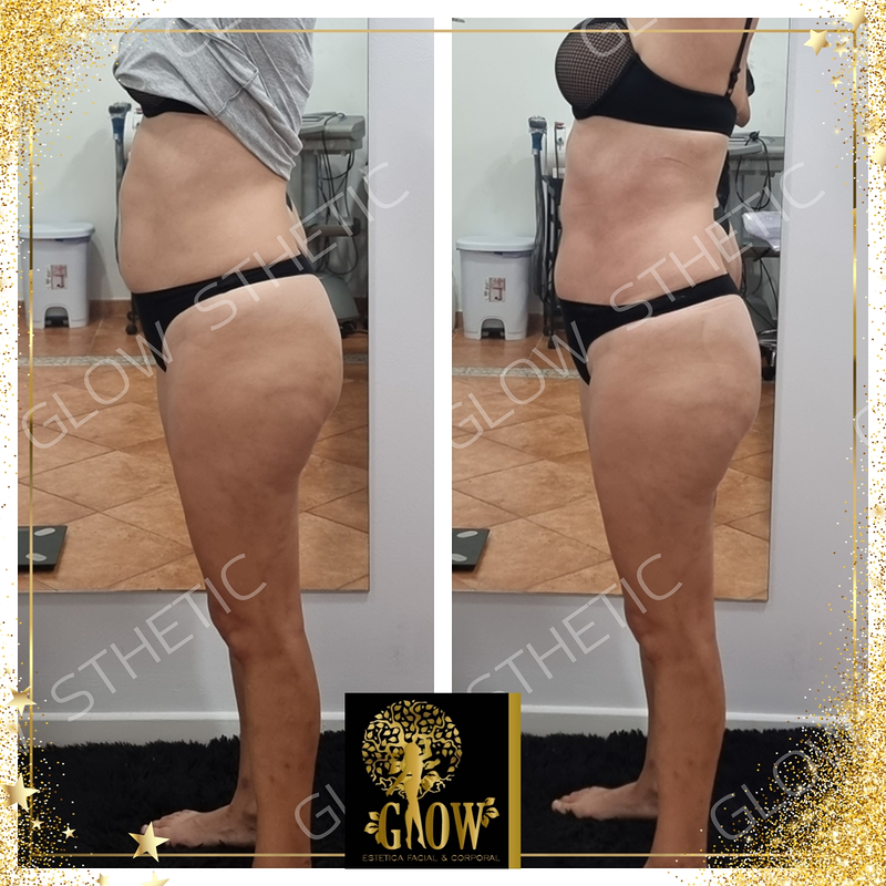 Glow Biosthetic ESTETICA: CENTROS