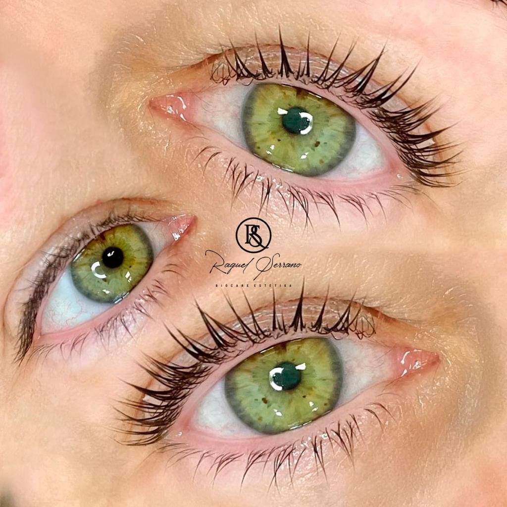 Biocare Estetika Raquel Serrano 5