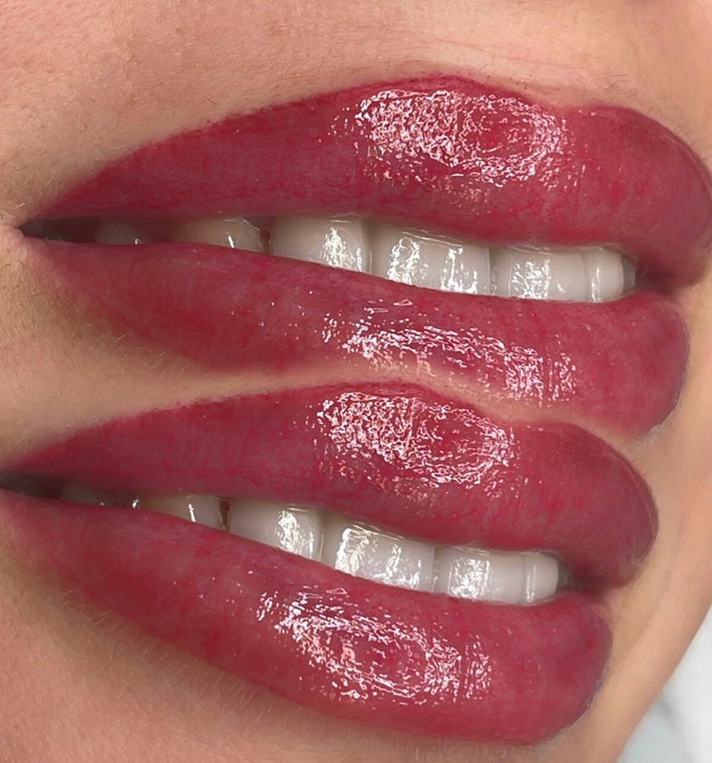 Biocare Estetika Raquel Serrano 40