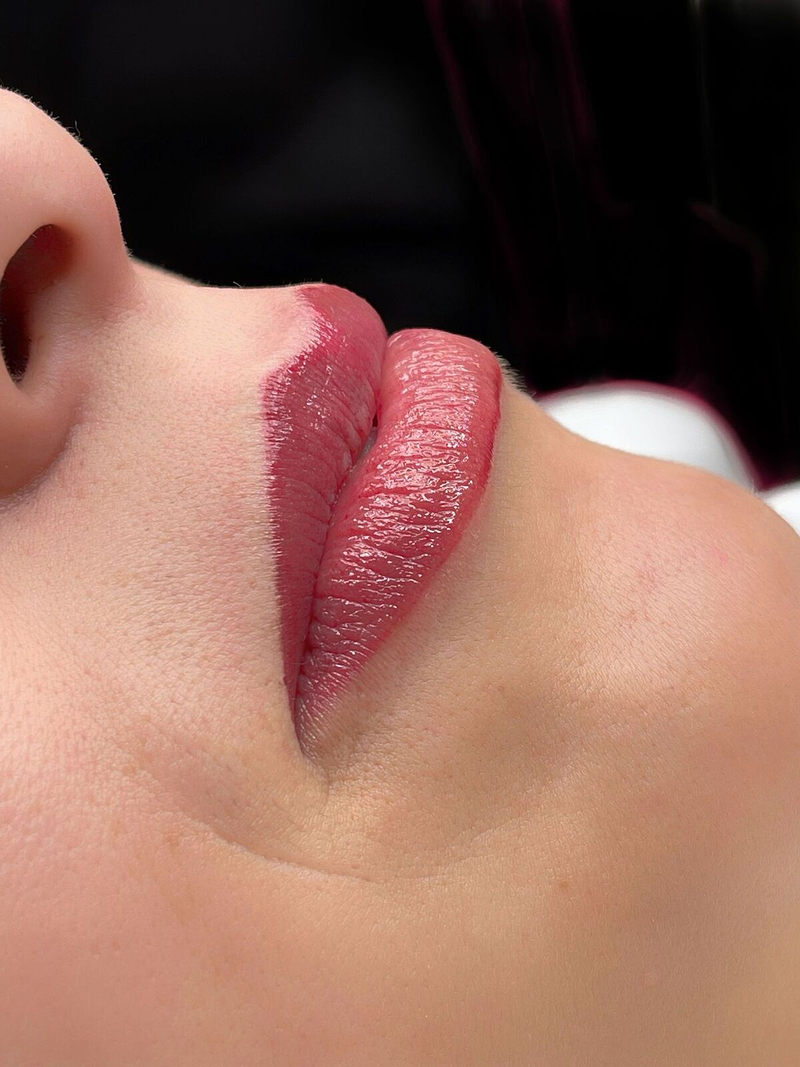 Biocare Estetika Raquel Serrano 44