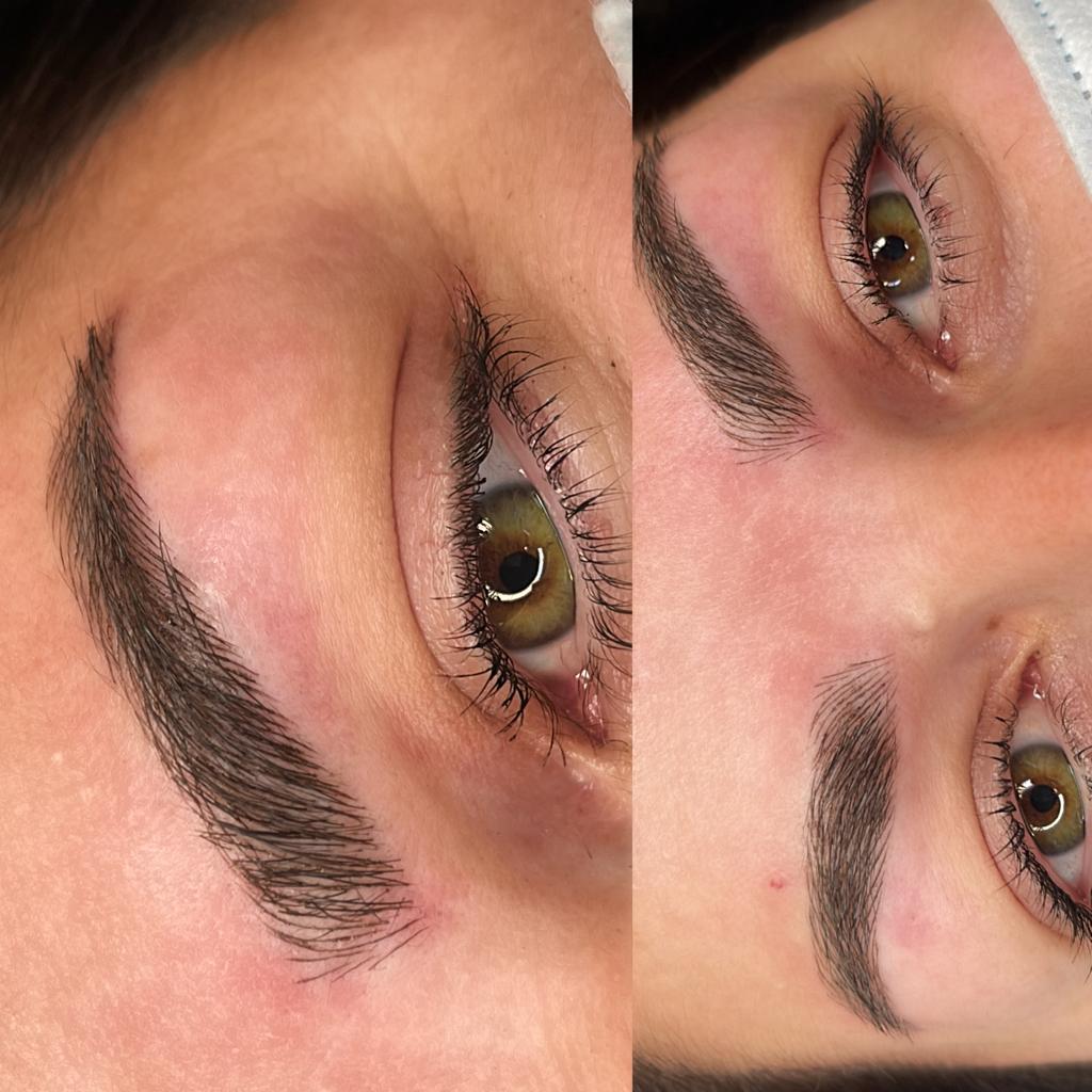 Biocare Estetika Raquel Serrano 4