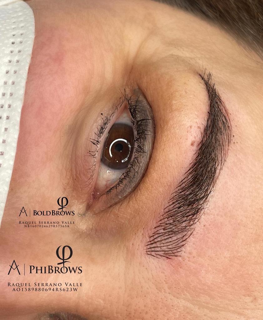 Biocare Estetika Raquel Serrano 14