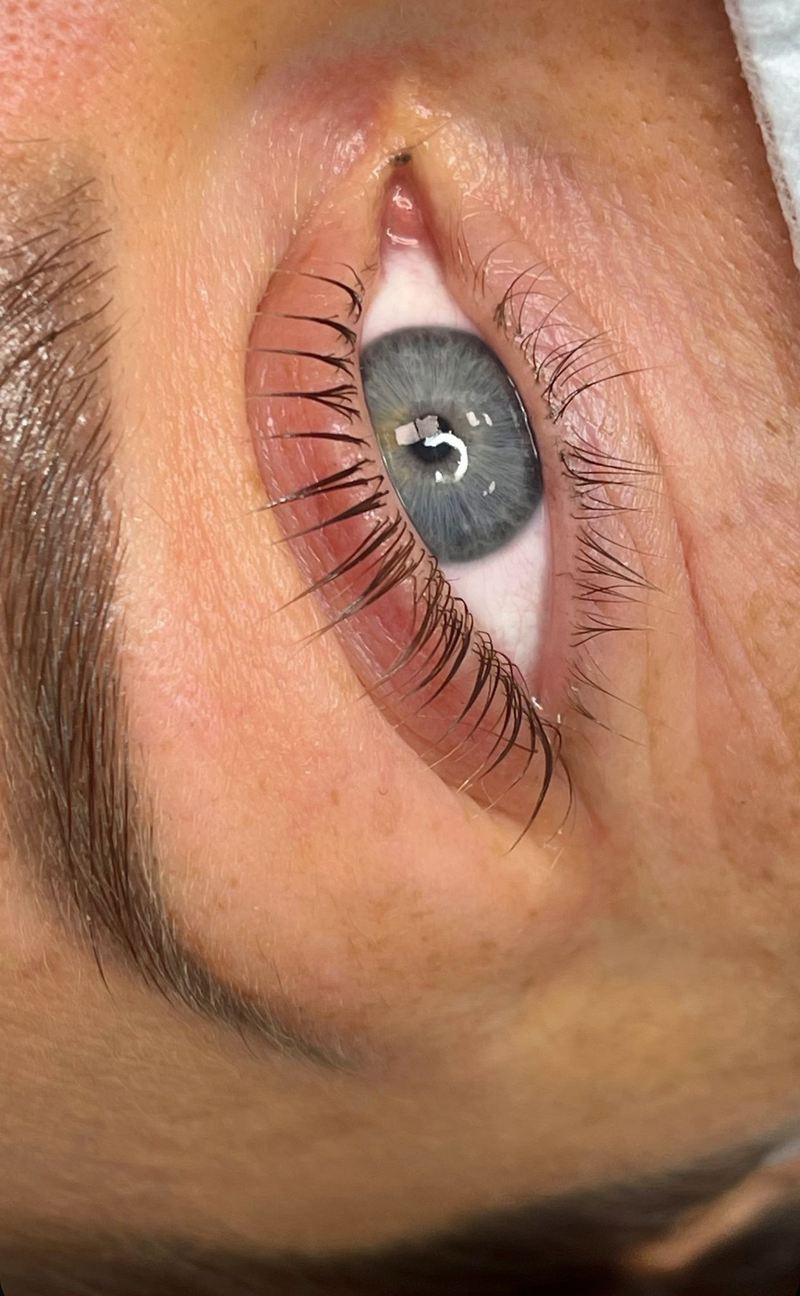 Biocare Estetika Raquel Serrano 37