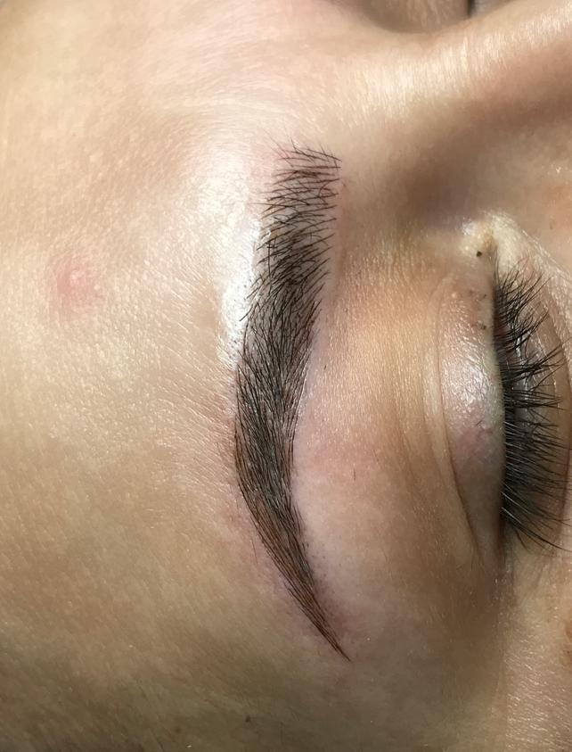 Biocare Estetika Raquel Serrano 12