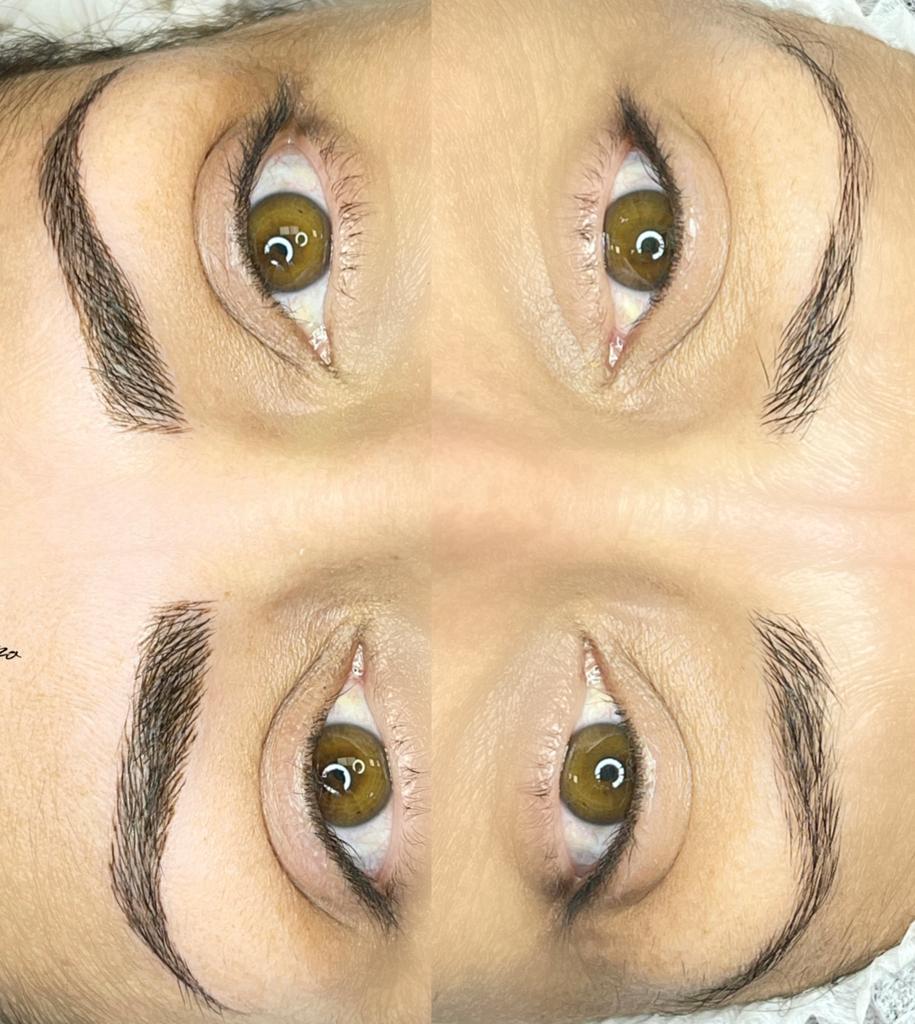 Biocare Estetika Raquel Serrano 22