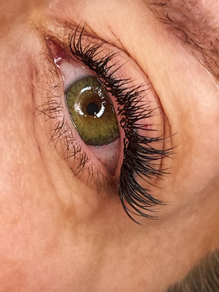 Biocare Estetika Raquel Serrano 26