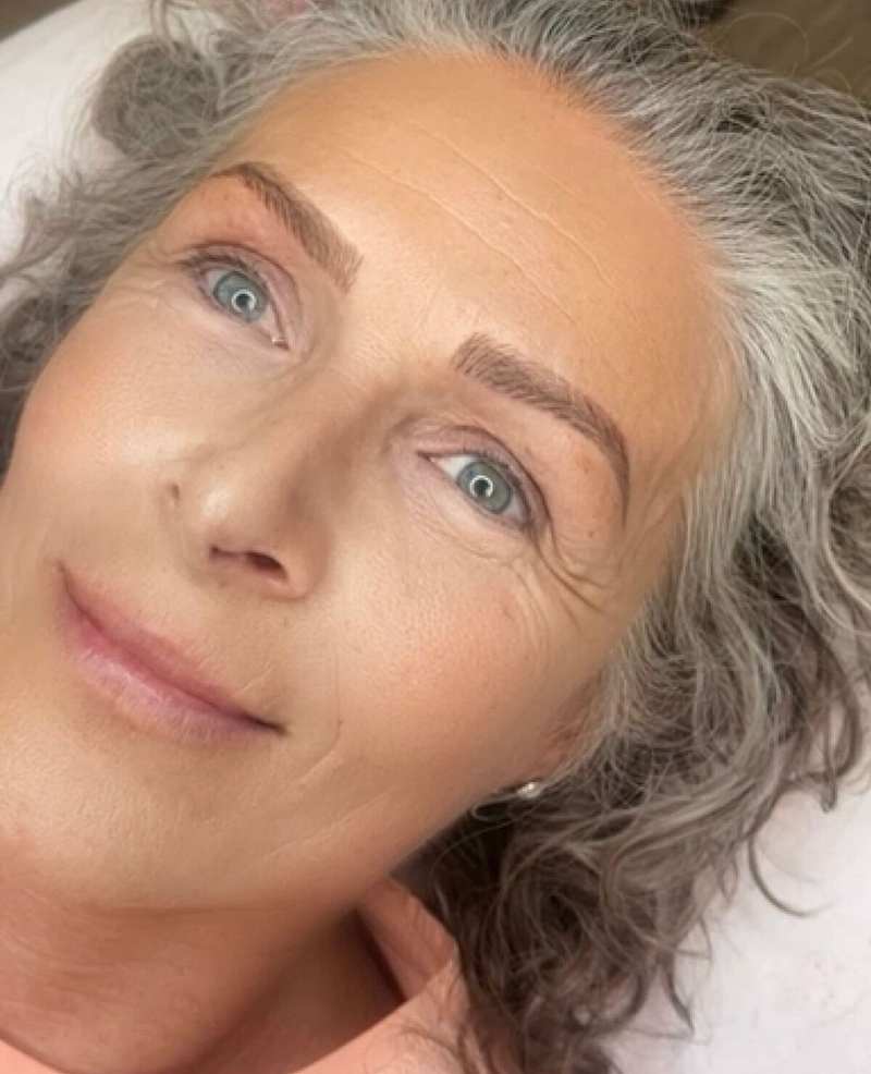 Biocare Estetika Raquel Serrano 49