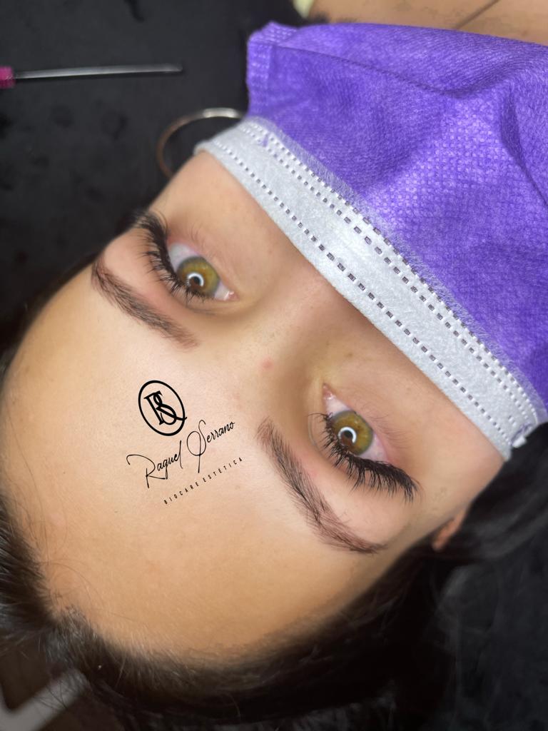 Biocare Estetika Raquel Serrano 8