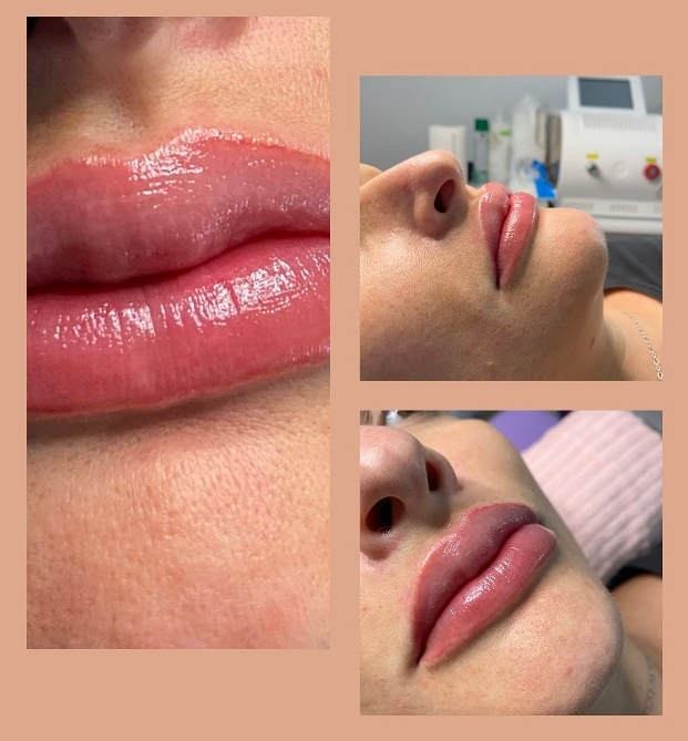 Esencial Est&eacute;tica Sabinillas 18